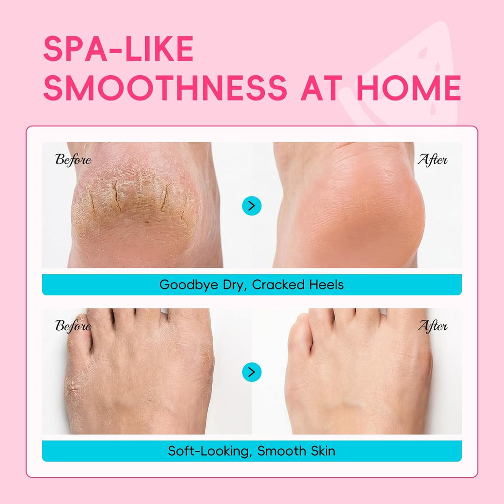 QUIYUM 6 Pairs Watermelon Foot Mask, Moisturizing Booties for Dry Skin