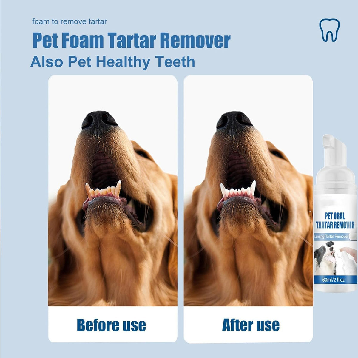 Pet Dental Foaming Spray, Tartar Remover, Dog Breath Freshener, 2pcs